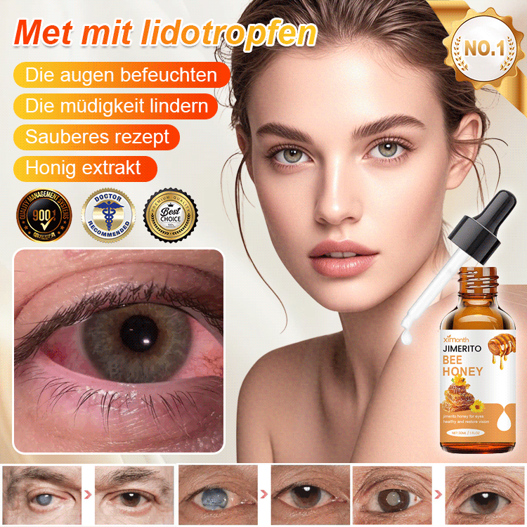 Gotas oftálmicas de miel Jimerito OFTÁLMICAS MILAGROSAS PARA PROBLEMAS DE OJOS/ OFERTA 2X1 ✅